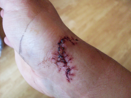 corvintaurus_krankenwagen_hand