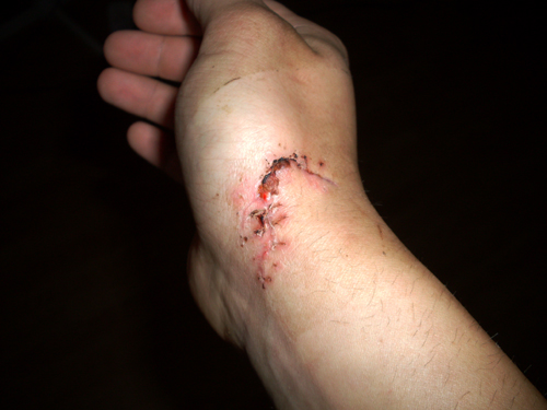 corvintaurus_krankenwagen_hand