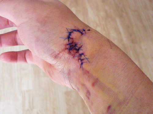 corvintaurus_krankenwagen_hand