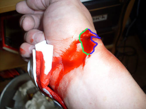 corvintaurus_krankenwagen_hand