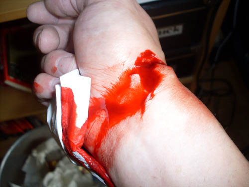 corvintaurus_krankenwagen_hand