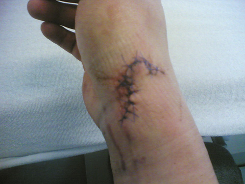 corvintaurus_krankenwagen_hand