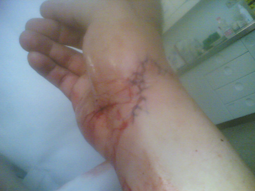 corvintaurus_krankenwagen_hand