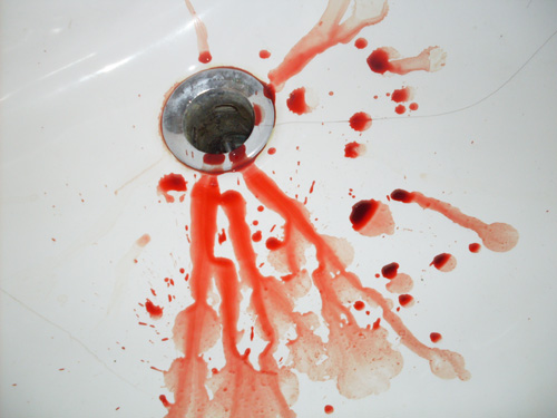 corvintaurus_krankenwagen_hand